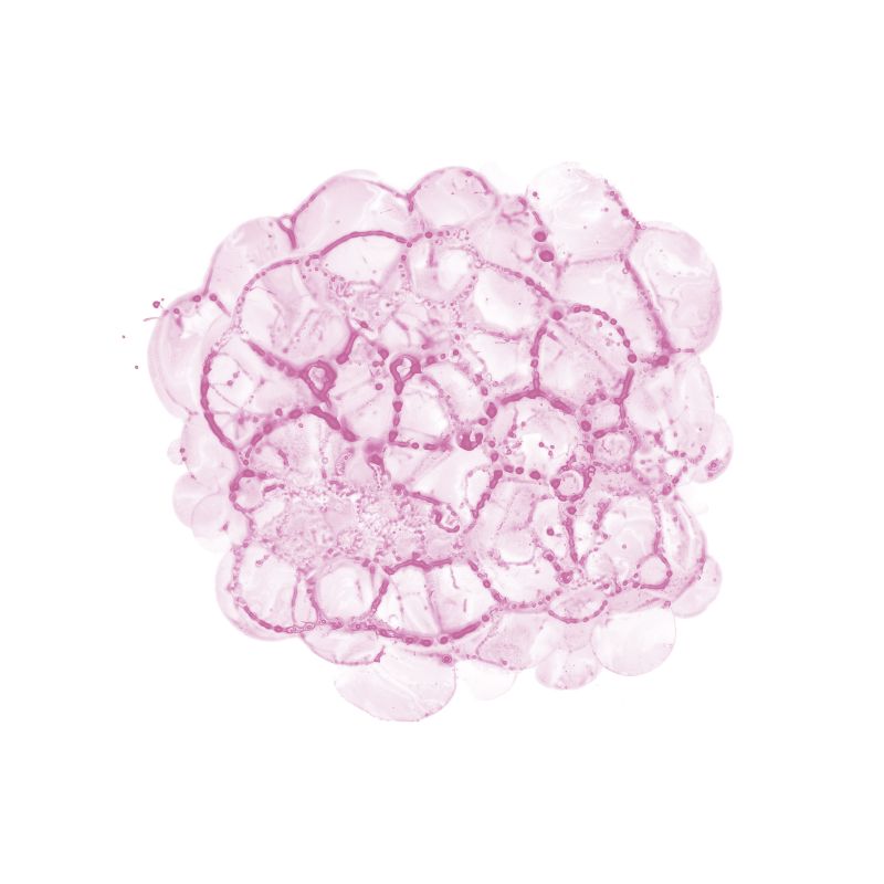 Cellular Clouds in Pink C
