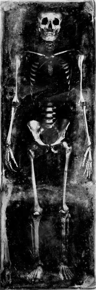 Skeleton I