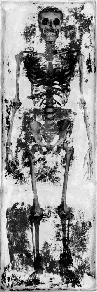 Skeleton IV